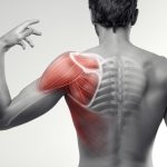Musculoesquelética