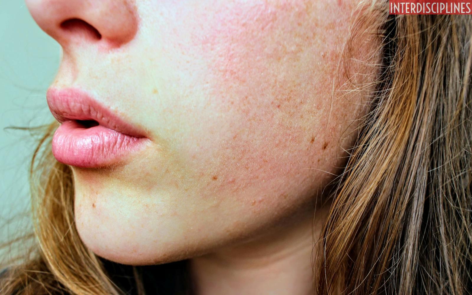 ¿Qué se necesita para un buen cuidado facial?